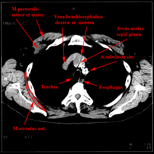 anatomia radiologiczna - 51.gif